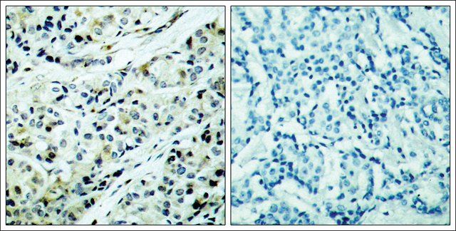 Anti-phospho-HDAC5 (pSer<sup>498</sup>) antibody produced in rabbit