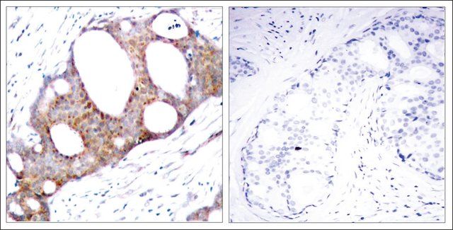 Anti-phospho-GSK3A (pSer<sup>21</sup>) antibody produced in rabbit