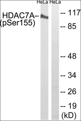 Anti-phospho-HDAC7A (pSer<sup>155</sup>) antibody produced in rabbit