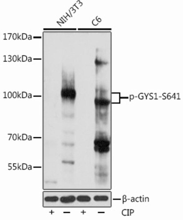 Anti-Phospho-GYS1-S641 antibody produced in rabbit