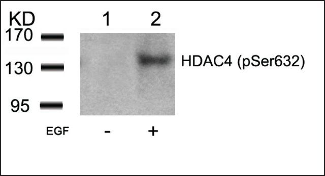 Anti-phospho-HDAC4 (pSer<sup>632</sup>) antibody produced in rabbit