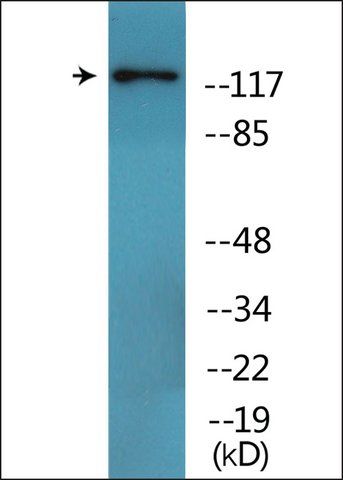 Anti-phospho-HDAC4 (pSer<sup>632</sup>) antibody produced in rabbit