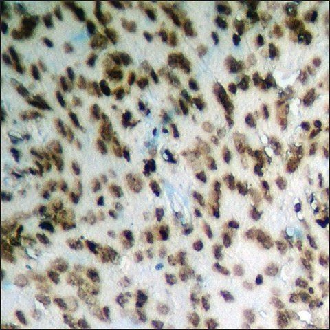 Anti-phospho-HDAC2 (pSer<sup>394</sup>) antibody produced in rabbit