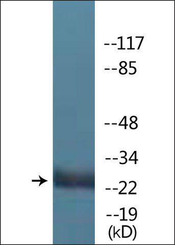 Anti-phospho-LAT (pTyr<sup>171</sup>) antibody produced in rabbit