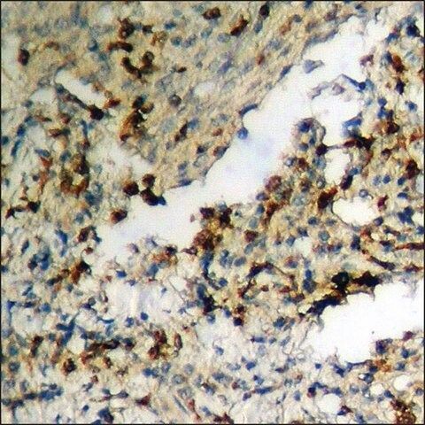 Anti-phospho-Huntingtin (pSer<sup>421</sup>) antibody produced in rabbit