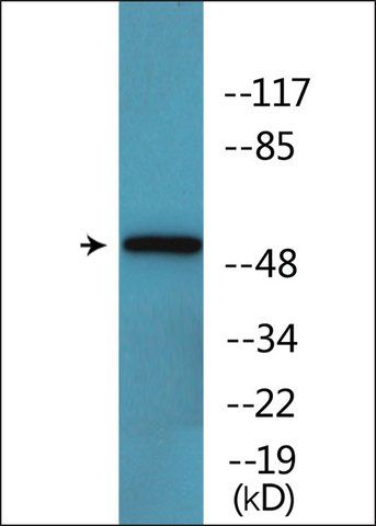 Anti-phospho-Keratin 8 (pSer<sup>432</sup>) antibody produced in rabbit