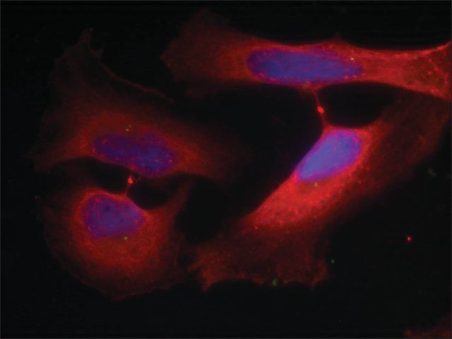 Anti-phospho-KRT8 (pSer<sup>74</sup>) antibody produced in rabbit