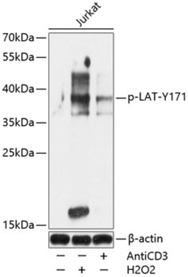 Anti-Phospho-LAT-Y171 antibody produced in rabbit