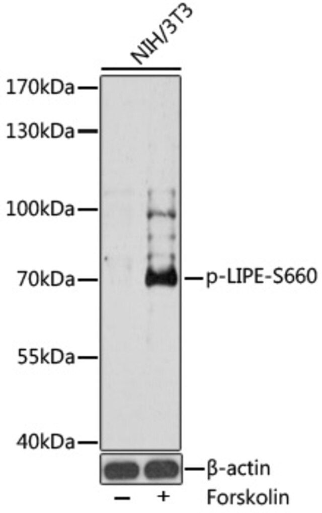 Anti-Phospho-LIPE-S660 antibody produced in rabbit