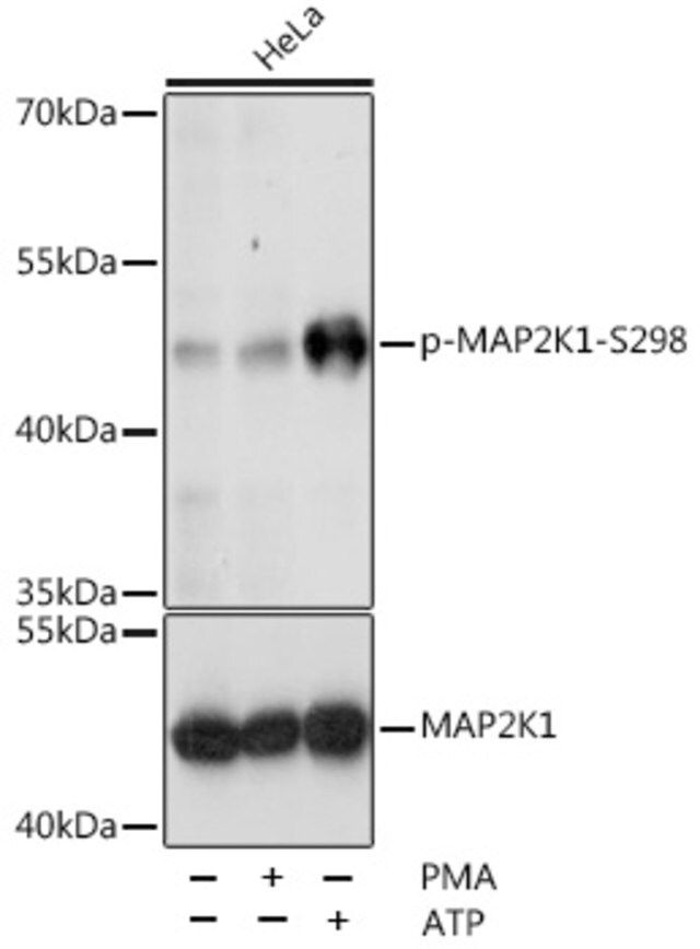 Anti-Phospho-MAP2K1-S298 antibody produced in rabbit