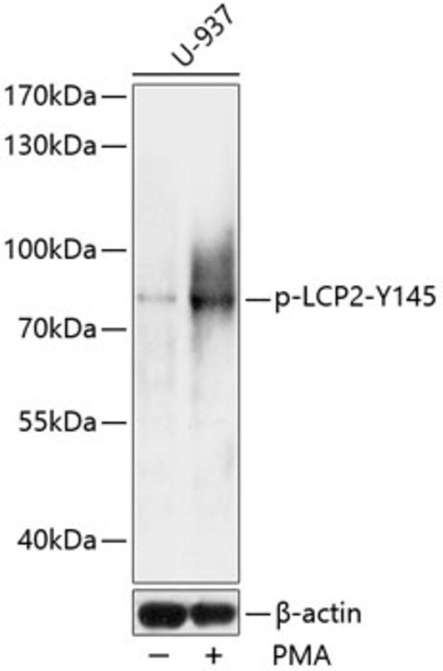 Anti-Phospho-LCP2-Y145 antibody produced in rabbit