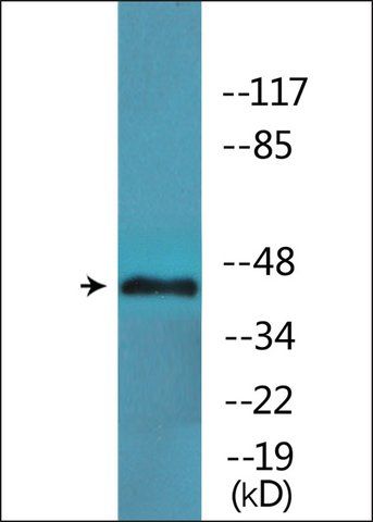 Anti-phospho-LEF-1 (pSer<sup>42</sup>) antibody produced in rabbit