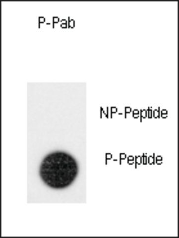 Anti-Phospho-Leo1-pS551 antibody produced in rabbit