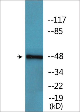 Anti-phospho-Keratin 18 (pSer<sup>52</sup>) antibody produced in rabbit