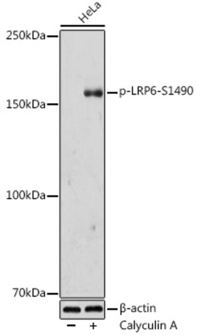 Anti-Phospho-LRP6-S1490 antibody produced in rabbit