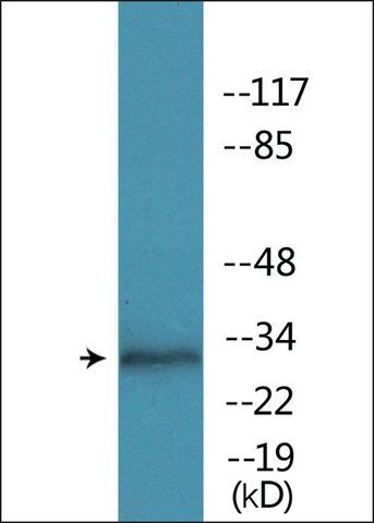 Anti-phospho-MARCKS (pSer<sup>158</sup>) antibody produced in rabbit