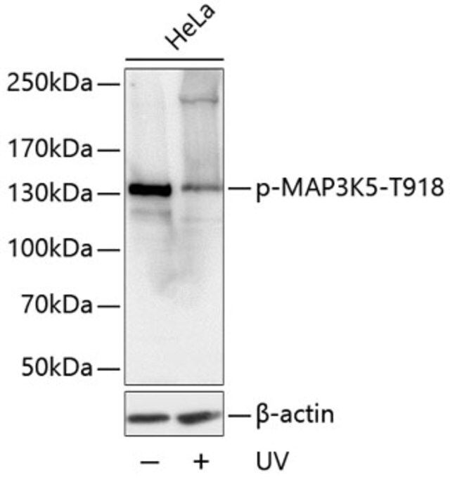 Anti-Phospho-MAP3K5-T918 antibody produced in rabbit