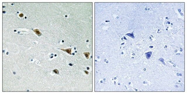 Anti-phospho-MAP2K7 (pSer<sup>271</sup>) antibody produced in rabbit