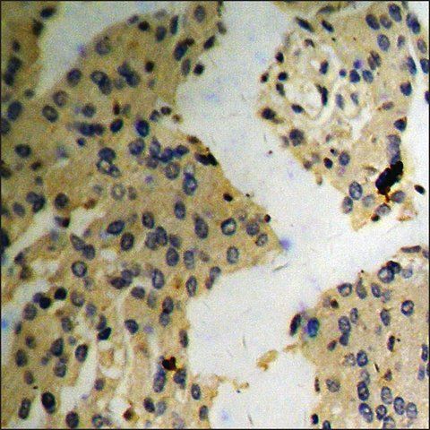 Anti-phospho-MARCKS (pSer<sup>163</sup>) antibody produced in rabbit