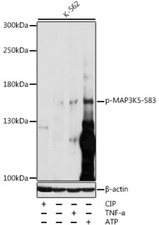 Anti-Phospho-MAP3K5-S83 antibody produced in rabbit