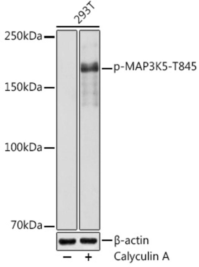 Anti-Phospho-MAP3K5-T845 antibody produced in rabbit