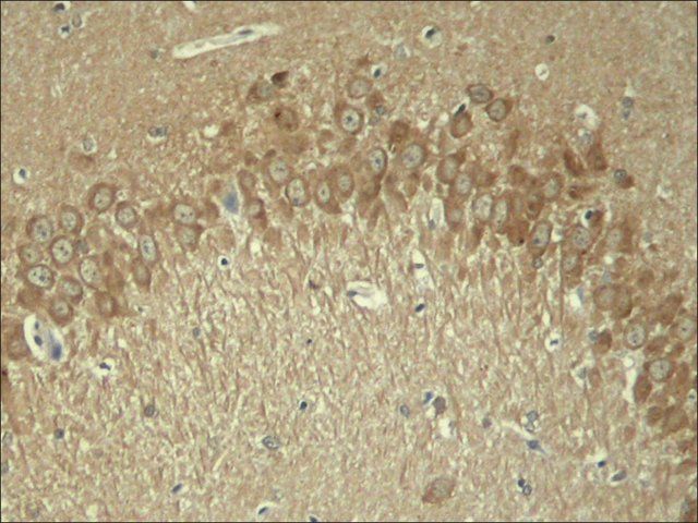 Anti-phospho-MAPT (pThr<sup>181</sup>) antibody produced in rabbit