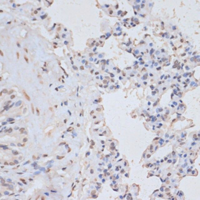 Anti-Phospho-MAPK3-Y204 antibody produced in rabbit