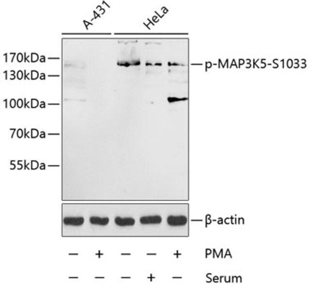 Anti-Phospho-MAP3K5-S1033 antibody produced in rabbit