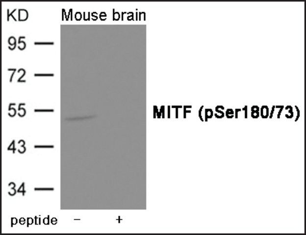 Anti-phospho-MITF (pSer<sup>180/73</sup>) antibody produced in rabbit