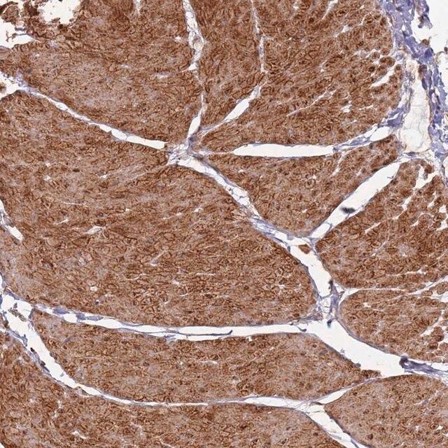 Anti-PHF21A antibody produced in rabbit