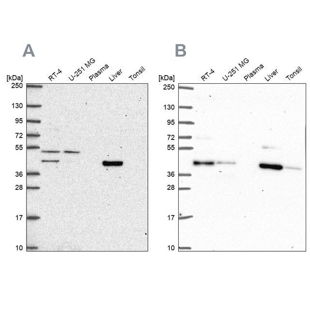 Anti-PHKG2 antibody produced in rabbit