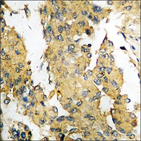 Anti-phospho-4E-BP1 (pSer<sup>64</sup>) antibody produced in rabbit