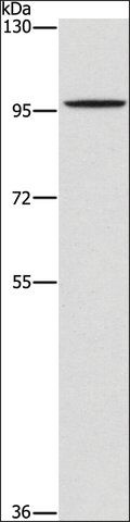 Anti-PDE6C antibody produced in rabbit