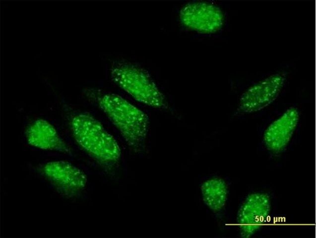 Anti-PDE4DIP antibody produced in mouse