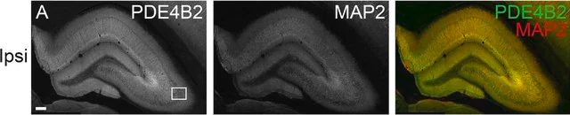 Anti-PDE4B2 Antibody