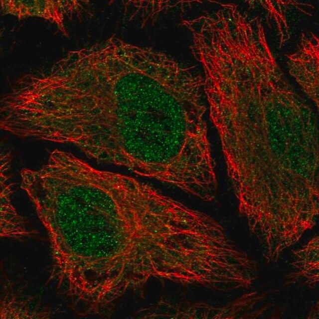 Anti-PDE8B antibody produced in rabbit