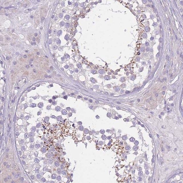 Anti-PDHA2 antibody produced in rabbit