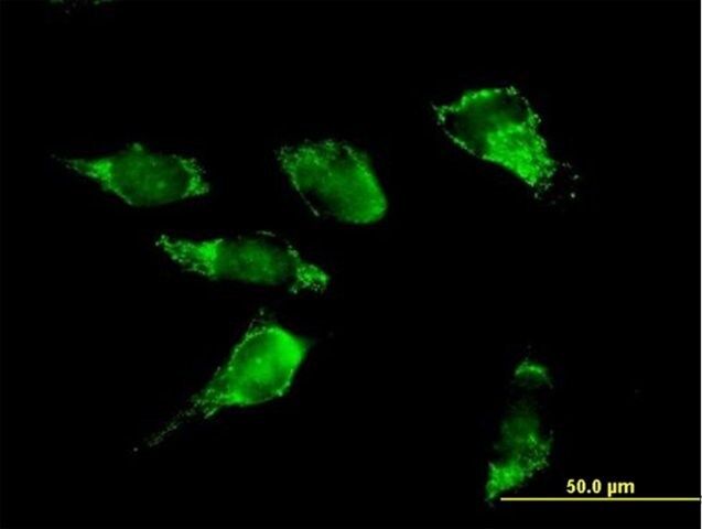 Anti-PDHA2 antibody produced in mouse