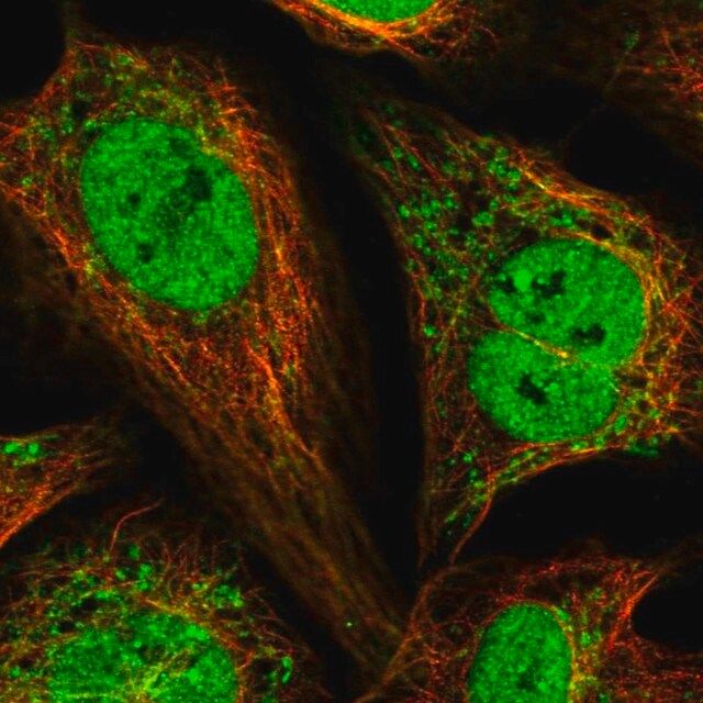 Anti-PAM16 antibody produced in rabbit