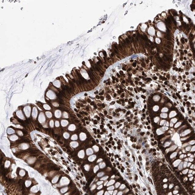 Anti-PAK1IP1 antibody produced in rabbit