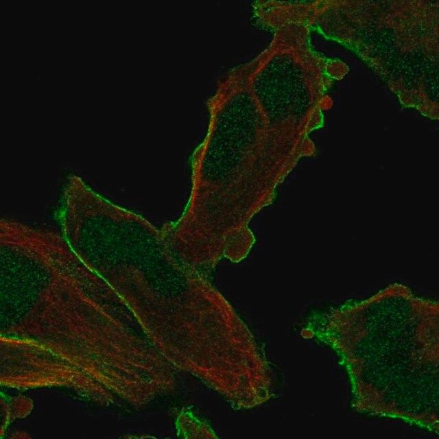 Anti-PALM2 antibody produced in rabbit