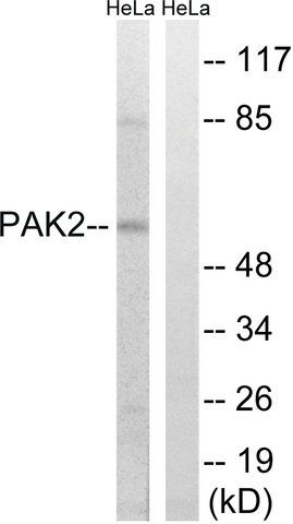 Anti-PAK2 antibody produced in rabbit