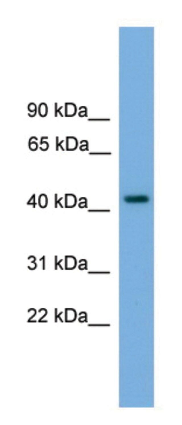 Anti-PALM (N-terminal) antibody produced in rabbit