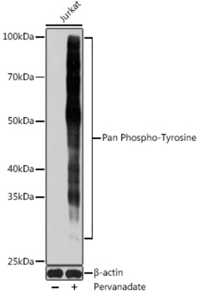 Anti-Pan Phospho-Tyrosine antibody produced in mouse