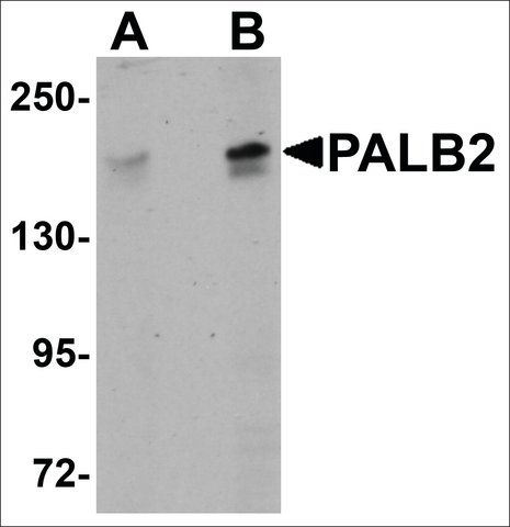 Anti-PALB2 antibody produced in rabbit