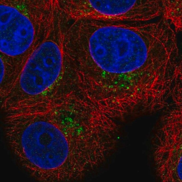 Anti-PAQR4 antibody produced in rabbit