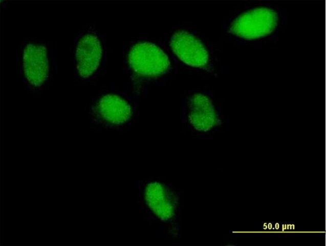 Anti-PARG antibody produced in mouse