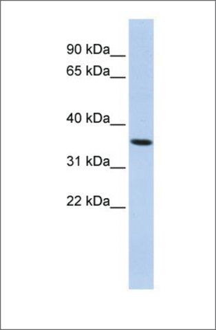 Anti-PAQR6 antibody produced in rabbit