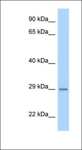 Anti-PAQR4 antibody produced in rabbit