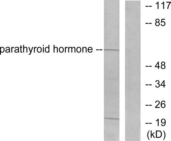 Anti-Parathyroid Hormone antibody produced in rabbit